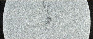 beadles_cultured_pearl_x-ray