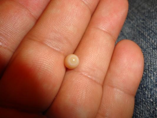 Le perle naturali Bursidae