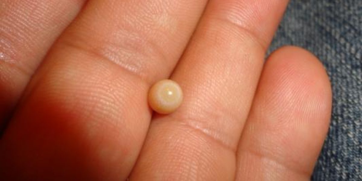 Genisi Perle naturali Bursidae